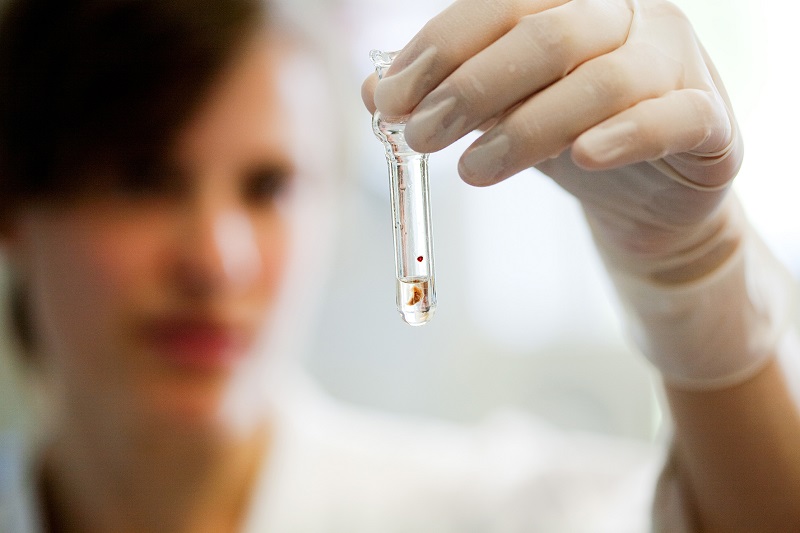 Die Anwendung und Entwicklung der vielversprechendsten Nanobody-Kandidaten soll in zuvor entnommenen Patient:innenzellen, Organoid-Kulturen und etablierten Tumormodellen untersucht werden.