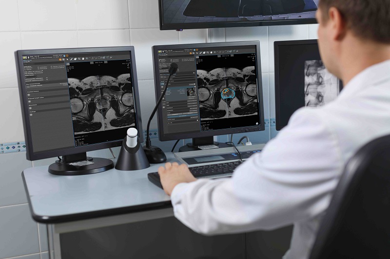 Unmittelbar im Viewer von mint Lesion erhalten Radiolog:innen die Resultate von Prostate.Carcinoma.ai. (Bild: FUSE-AI)